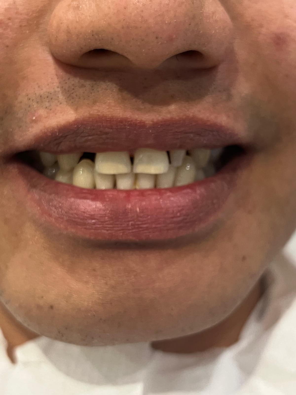 ECE Dental Patient Transformation